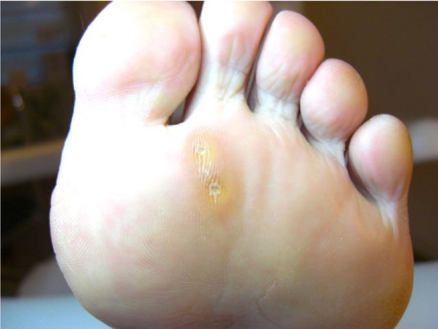 硬いしこりはどのように診断されますか?