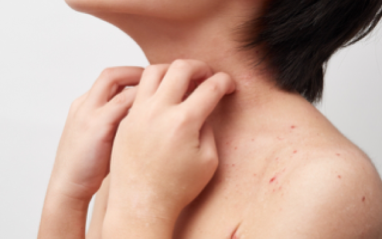 あなたはアトピー性皮膚炎でこんなお悩みはありませんか？