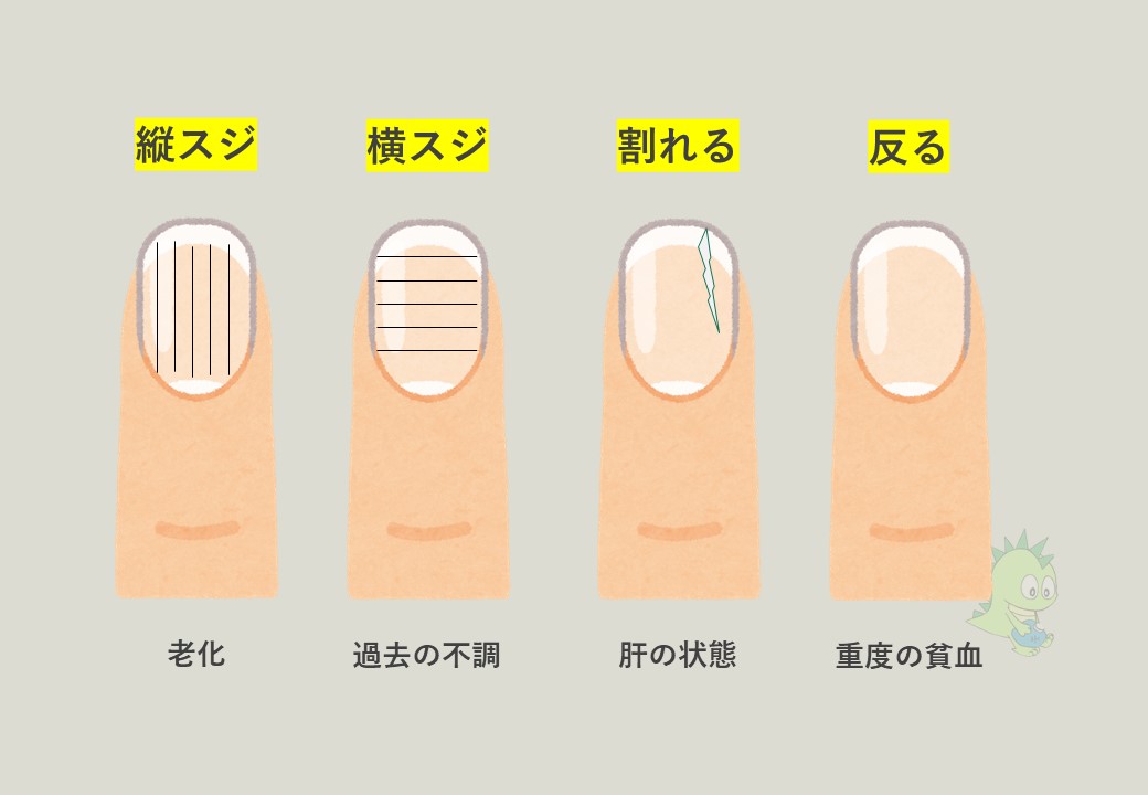 年6月最新 爪 で診る健康状態 東洋医学で見る体調管理術 大阪でアトピー 頭痛 自律神経の不調ならオルソ鍼灸院